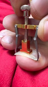 2.9M views · 3.2K reactions | How to fix ingrown toenails #fblifestyle | The Ryan And Amber Show | Facebook