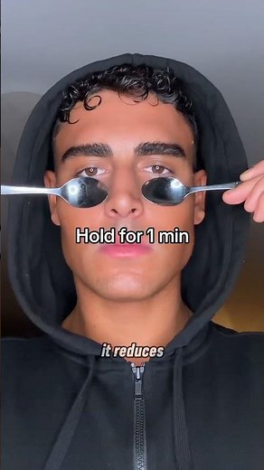 5 Natural Ways to Remove Dark Circles FAST!