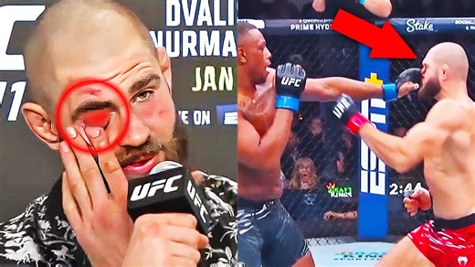 Jiri Prochazka REACTS to Eye Poke vs Jamahal Hill UFC 311 Fight Highlights