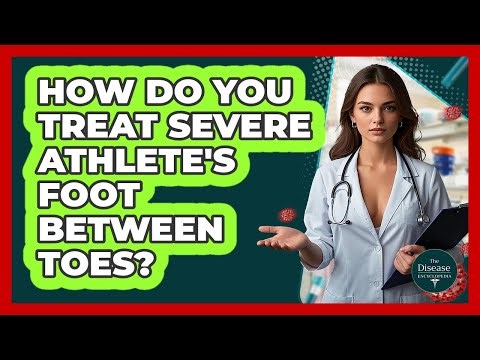 How Do You Treat Severe Athlete's Foot Between Toes? - The Disease Encyclopedia