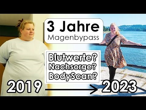 3 Jahre Magenbypass - Omega Loop - Nachsorge, Zunahme, Blut & BodyScan | PrimaDina