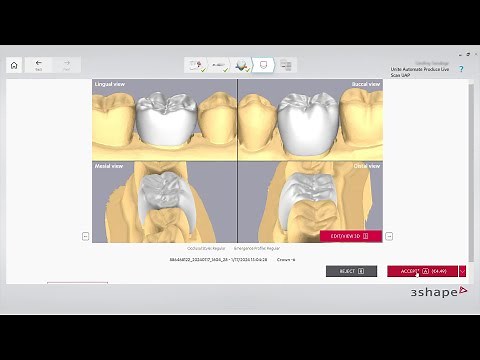 Automate crown in Unite workflow