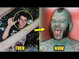 13 People Who Took Plastic Surgery To The Extreme