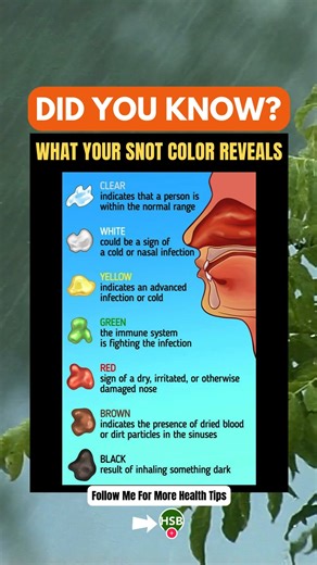 Snot Color Guide: What’s Coming Out of Your Nose? 🤧🌈 From clear to green to yikes black—your mucus has a lot to say about your health! 🦠👃 Learn what each snot color really means and when it’s time to see a doctor. #HealthTips #ColdSeason #SnotColorGuide | Health Spirit Body