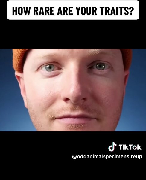 How Rare Are Your Traits? #science #learnontiktok | palmaris longus