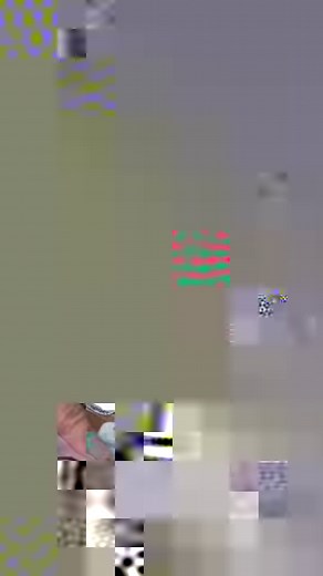 Hear directly from industry experts about their firsthand experience with Sofwave’s latest muscle toning add-on module, Pure Impact™, with Dr. Gregory P. Mueller, Board Certified Plastic Surgeon from Beverly Hills, USA. “Our targeted patients are those who are using skinny shots like any of the GLP-1 weight loss medications. They are great choices for the technology because of the muscle loss while also addressing their loose overlying skin, full body plyometric combined with Sofwave™ provides n