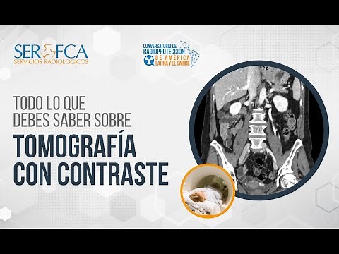 Conversatorio: Todo lo que debes saber sobre Tomografías con Contraste.
