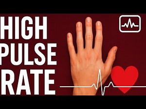 Heart Beating Too Fast? Here’s What It Means! | Tachycardia Explained