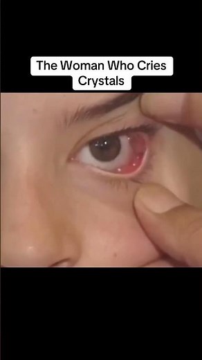 People with Superpowers in Real Life😳 #shorts