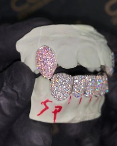 280 reactions · 104 shares | Pink & Blue Diamond Fangs  | Custom Gold Grillz | Facebook