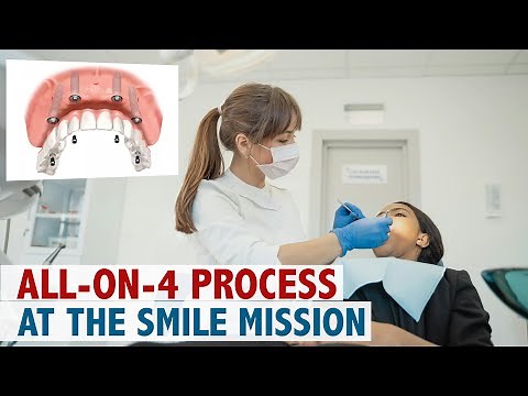 All-On-4 Process at The Smile Mission