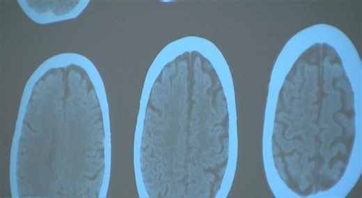 When our tech analyst had a stroke