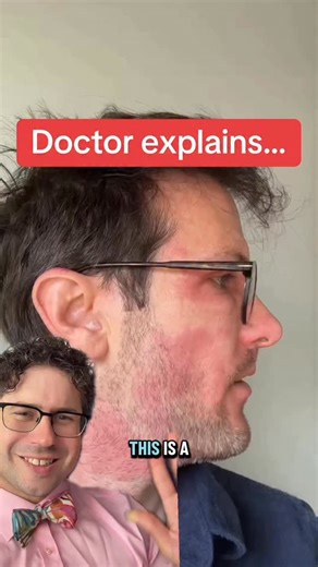 Zachary Rubin, MD on Instagram: "What is this rash? What is allergic contact dermatitis? #allergies #rash #doctor"