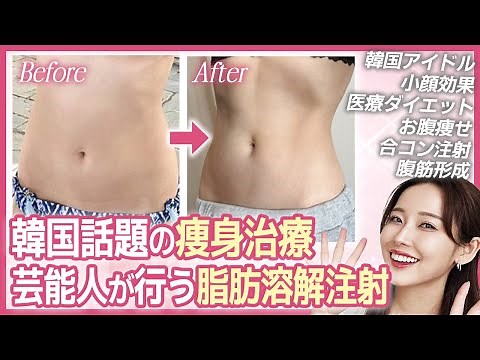 【韓国美容医療体験談】脂肪吸引必要なし！日本語対応OK！韓国アイドルも行う脂肪溶解注射。美容施術、ダウンタイム、効果、ビフォーアフター完全密着！痩せたい、痩身、小顔(幅縮小)、お腹痩せについて完全公開