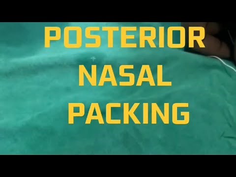 Posterior Nasal Packing with gauge ..#epistaxis #nasalsurgery #entdoctor #entproblems #ent #entlive
