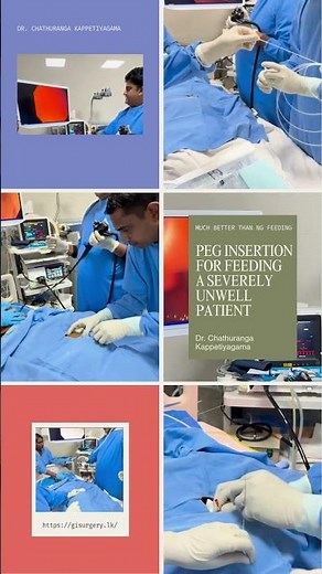 PEG Insertion Procedure by Dr. Chathuranga Kappetiyagama | GI Surgeon. #PEGInsertion