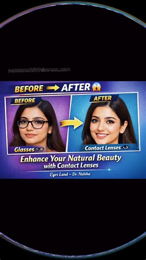 “Glasses vs Contact Lenses – See the Difference 👓➡️👁️”#drnabiharasheed#contactlenses #fyp #eyes