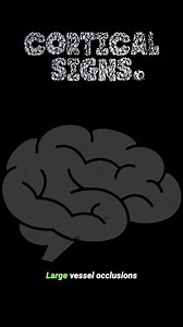 Cortical Signs | FOAMfrat