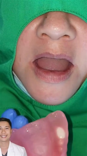 🩺 “Over time, traditional dentures don’t just feel inconvenient—they can wear away jawbone and make your face look saggy, slowly changing the natural shape you’re used to.”— Dr. William Hart Our Expert-Designed Full Denture is here to fix that. Crafted by seasoned dental specialists, it’s made just for your mouth: a stable, tailored fit that cuts out all the discomfort traditional dentures bring. ✨ Holds up your facial structure, keeping its fullness✨ Feels like your real teeth—secure, no slipp