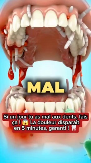 Partie 28 l Tu souffres d'un mal de dents ? Essaie ce remède maison, le résultat est bluffant !#maldedents #remedenaturel #dents #remèdemaison