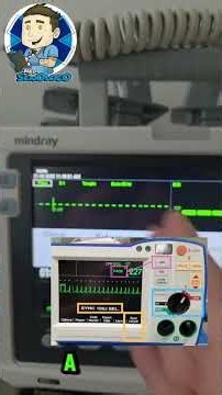 ⚡ TERAPIA ELÉCTRICA: DESFIBRILACIÓN - CARDIOVERSIÓN - MARCAPASOS TRANSCUTÁNEO