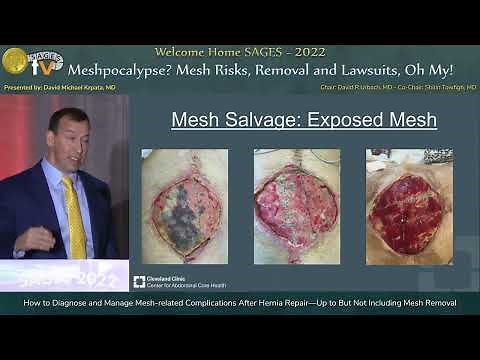 How to Diagnose and Manage Mesh-related Complications After Hernia Repair—Up to But Not Includin...