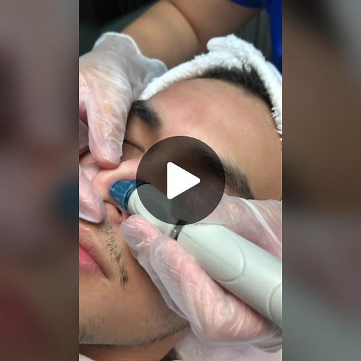 Just HydraFacial things to get your Monday going 😌 #hydrafacial #hydrafacialcebu #hydrafacialtreatment