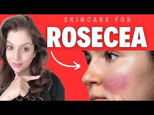 New Skincare Routine For Rosacea And Sensitive Skin!