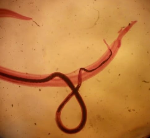 Experts uncover how cancer-causing parasitic worm enters your body… without you noticing