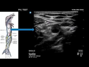 AEUS Narrated Lecture Series: Peripheral IV Placement