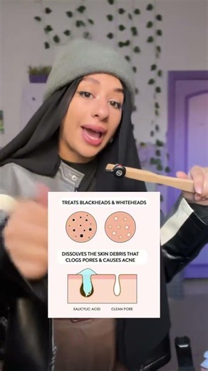 إزاي تتخلصي من الـ Whiteheads فعلًا (مش بس تغطيها) 😳✨
