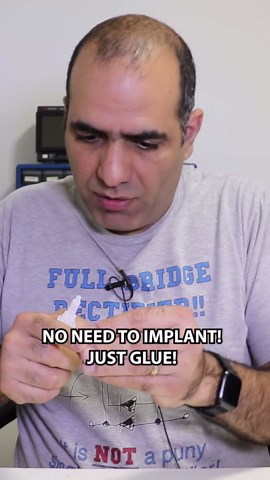 Finger Magnet Implant #sensor #technology #experiment | Magnets