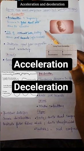 ACCELERATION AND DECELERATION