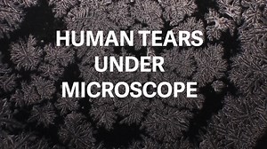When dried under a microscope, your tears are beautifully unique—like fingerprints or snowflakes. | Quartz