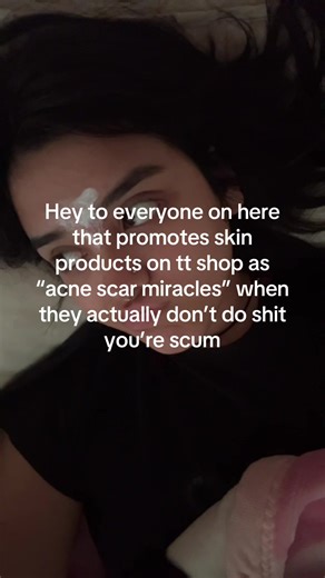 There exists no universal “miracle working product”. Like there are girls/boys/ppl out there buying that hoping this’ll be the thing to solve their deepest insecurity only to realize a loser scum person lied to them to make a couple cents. Ft. me in my acne cream. #scam #ttshop #insecurities #acne #miracleproduct