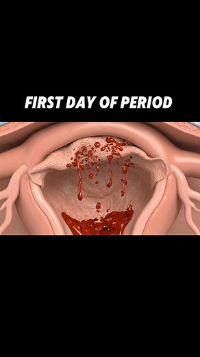 606K views · 2K reactions | First day of period painfull process inside view #period #process #human #anatomy #foryoupagereels | Doctor Aliza | Facebook