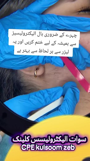 Swat electrolysis clinic on TikTok