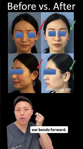 Dr Lao's Case Files 6 Otoplasty
