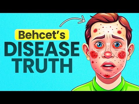 What Happens When You Have Behcet’s Disease? | Victortheinspiration Animation
