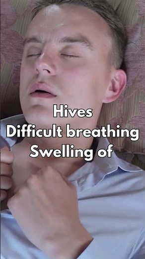 FEXOFENADINE (ALLEGRA/TELFAST) 💊 SIDE-EFFECTS YOU SHOULD KNOW!