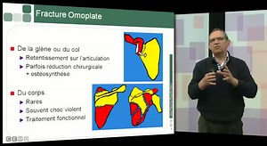 IFSI 2013 - Les processus traumatiques : 03 - Traumatologie de l'épaule | Canal U