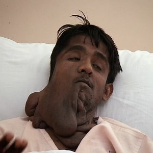 Man must get life-threatening surgery on his face to remove this tumor, which the Dr says is the biggest he's ever seen! 😳👨‍⚕️#BodyBizarre | TLC UK