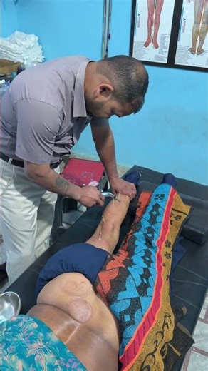 sciatica treatment in acupuncture