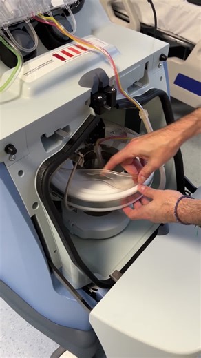 Apheresis: saving lives today and driving innovation tomorrow | Anthony Nolan: Cell Therapy and Laboratory Services