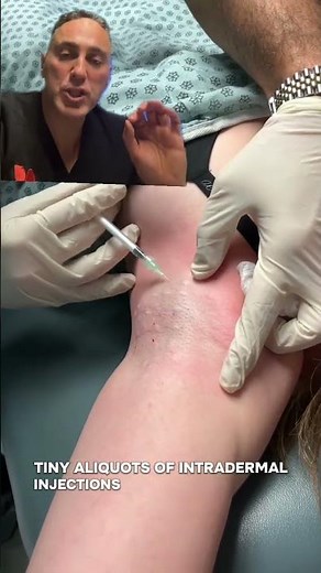 Botox for Underarm Sweating