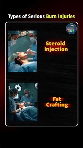 3 Types of Burn🔥Injuries You Should Never Ignore 🚨From Mild to Life-Threatening 🚑#burntreatment