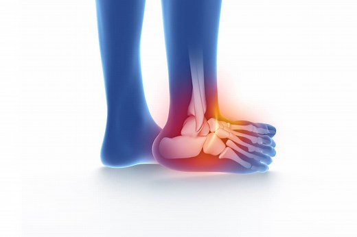 Entorse de cheville : conduite à tenir et prise en charge