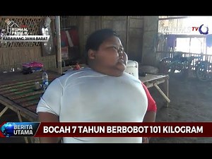 Berat Badan, Arya, Bocah Obesitas Berangsur Ideal