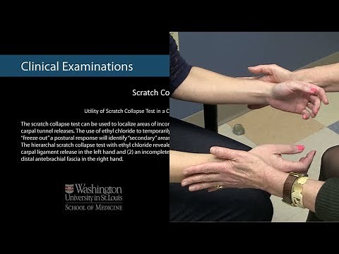 Utility of Scratch Collapse Test in a Case of Failed Carpal Tunnel Releases