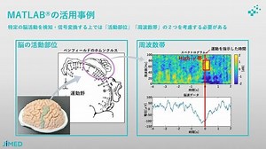 ブレイン・マシン・インターフェースにおける世界初の挑戦とその将来展望